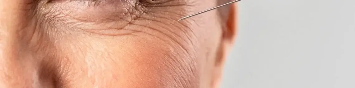 Visage d'une femme recevant un soin anti-âge sous la forme d'une injection de produit à côté de l'oeil
